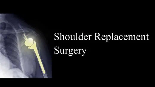 Shoulder replacement surgery in Greater Noida West